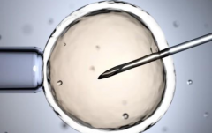 乌克兰私立医院试管包成功可信度高吗？内部人士揭露真实情况