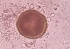 2026年马来西亚三代试管婴儿包成功是真的吗？操作流程与关键注意事项