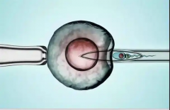 国内无结婚证单身女性在郑州三附院能做试管吗？