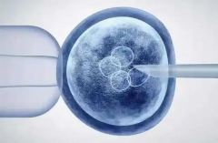 2026年在美国做三代试管包成功有保障吗？附上医院信息