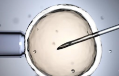 2026年国外三代试管承诺包成功可信吗？操作步骤与注意事项说明