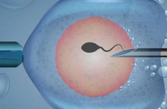 试管包干服务套餐真相：省心还是套路？