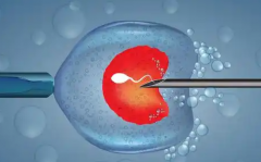 广州市第一人民医院未婚试管成功率真实数据是多少