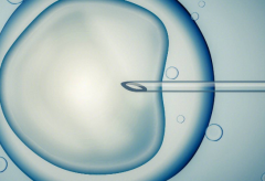 2026年单身女性在商丘市一院做试管婴儿总费用是多少