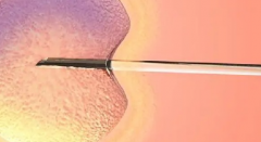 玉林市妇幼保健院未婚女性试管婴儿成功率怎么样？