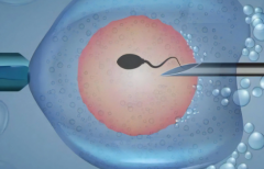 柳州工人医院单身试管成功率数据揭秘：真实案例分享